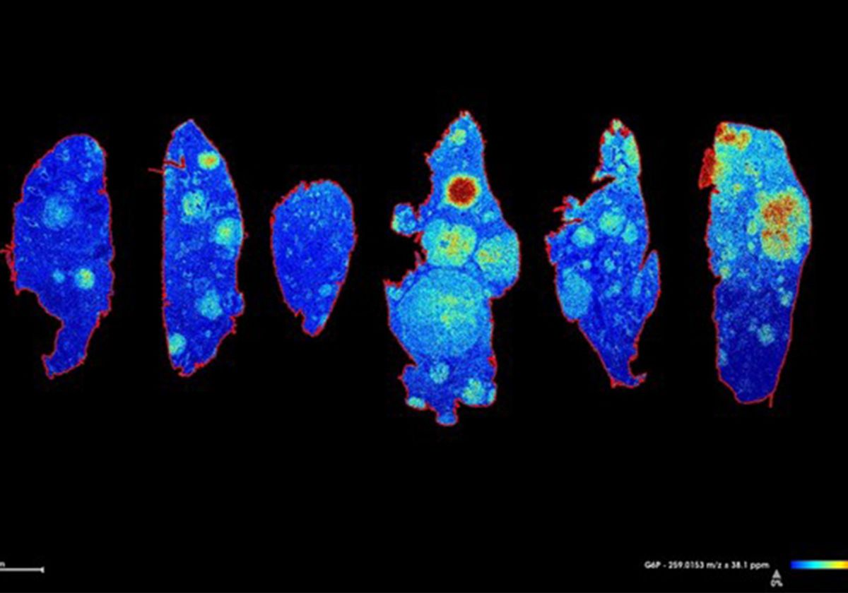An image of lung tissue acquired using a MALDI imaging mass spectrometer.