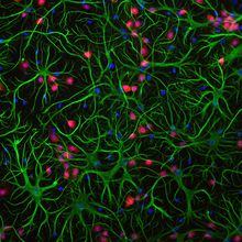 An image of neurons, astrocytes, and other glial cells acquired using fluorescence microscopy.