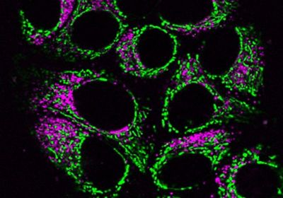 Fluorescence microscopy image of cells expressing fluorescent biosensors. Green and magenta fluorescence is observed outside of the cell nuclei.
