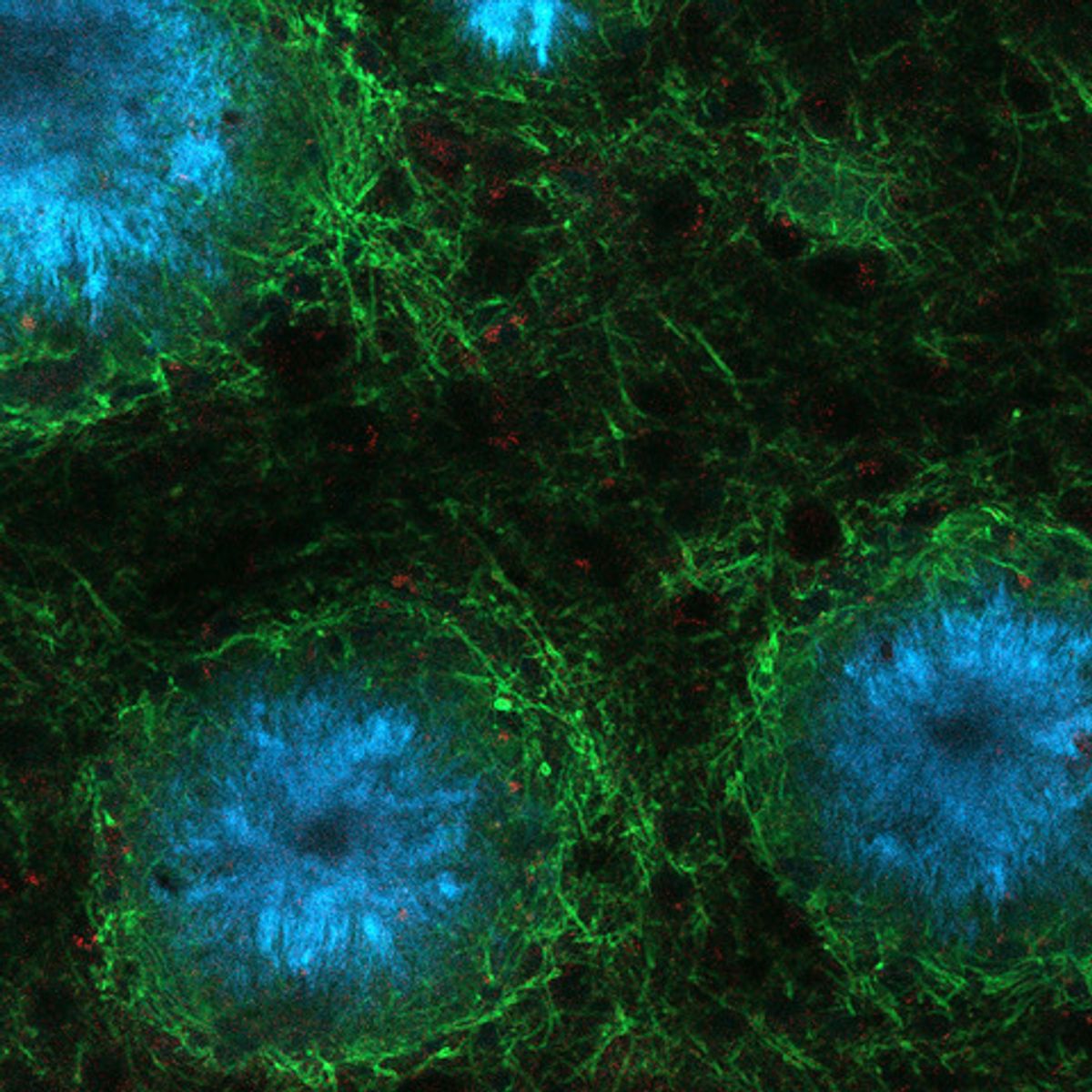 Fluorescence microscopy image of blue amyloid plaques and green microglia in a mouse brain tissue.