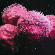 Artist&rsquo;s 3D rendering of malignant cancer cells, illustrated in pink, as it would appear under a scanning electron microscope.