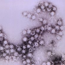 Microscopic image of a poliovirus