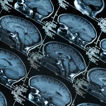 Tiled blue-gray MRI readouts of a human brain.