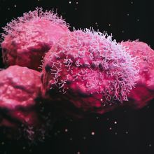 3D rendering of a scanning electron micrograph of pink malignant cancer cells against a black background