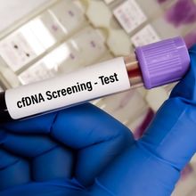 A blood test tube with the label &lsquo;cfDNA Screening&ndash;Test&rsquo;, held in a hand wearing blue gloves.