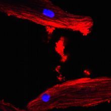 Mouse heart cells that have taken up adipocyte-derived extracellular vesicles (stained red)