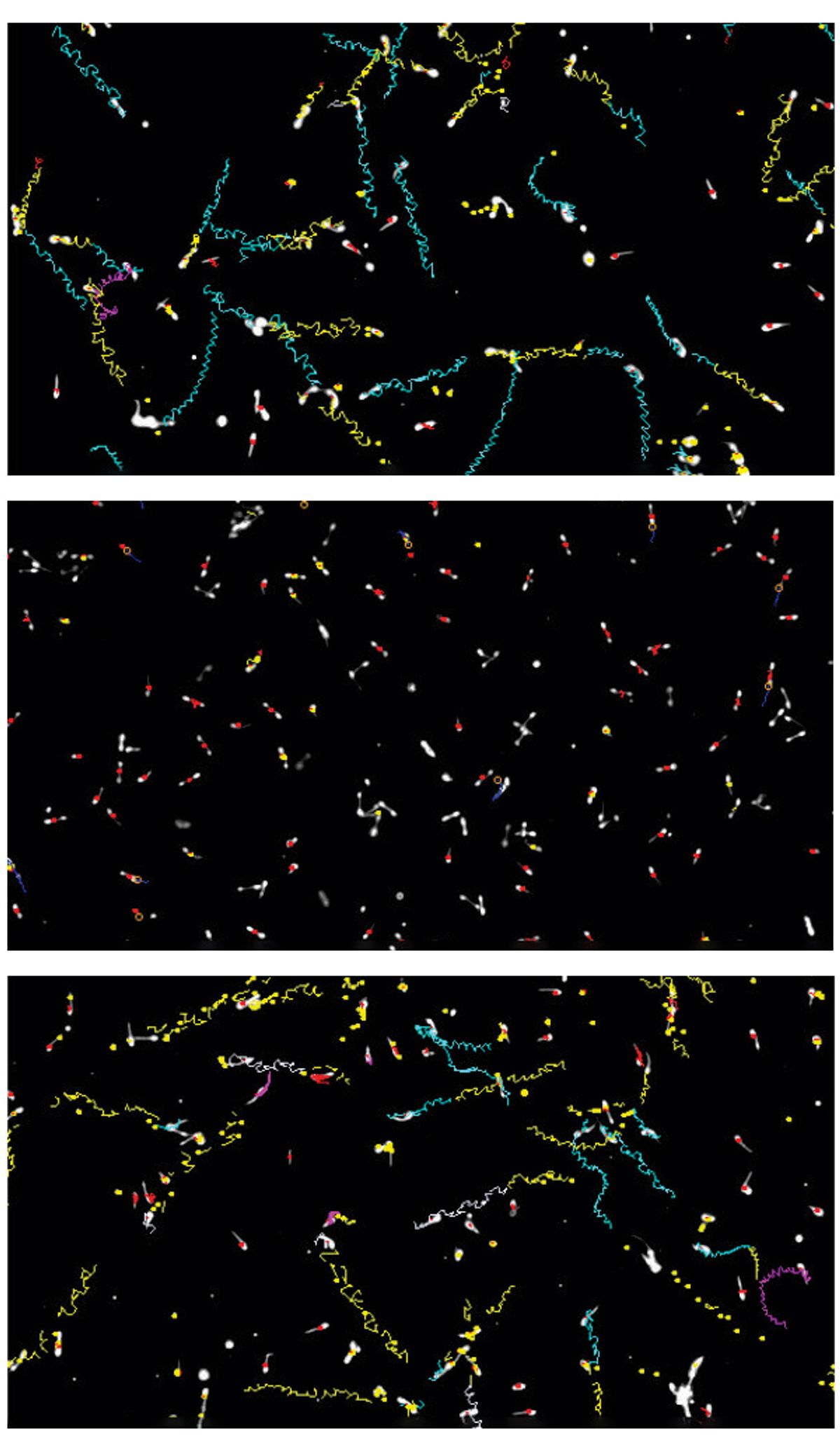 Three separate pictures showing sperm motility tracks before treatment with the inhibitor (top), one hour after exposure to the inhibitor (middle) and 24 hours after exposure (bottom). The top and bottom images look almost identical, with long squiggly lines emanating from each sperm. The middle image, in contrast, has no squiggly lines, showing the sperm's inability to move.