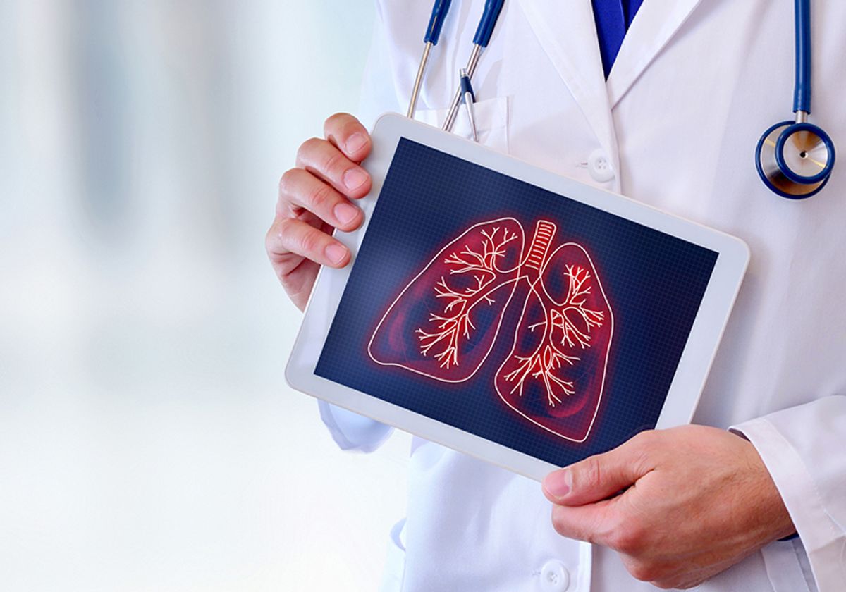 A clinician holding a graphic of the lungs on a tablet