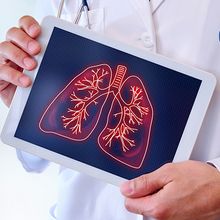 A clinician holding a graphic of the lungs on a tablet