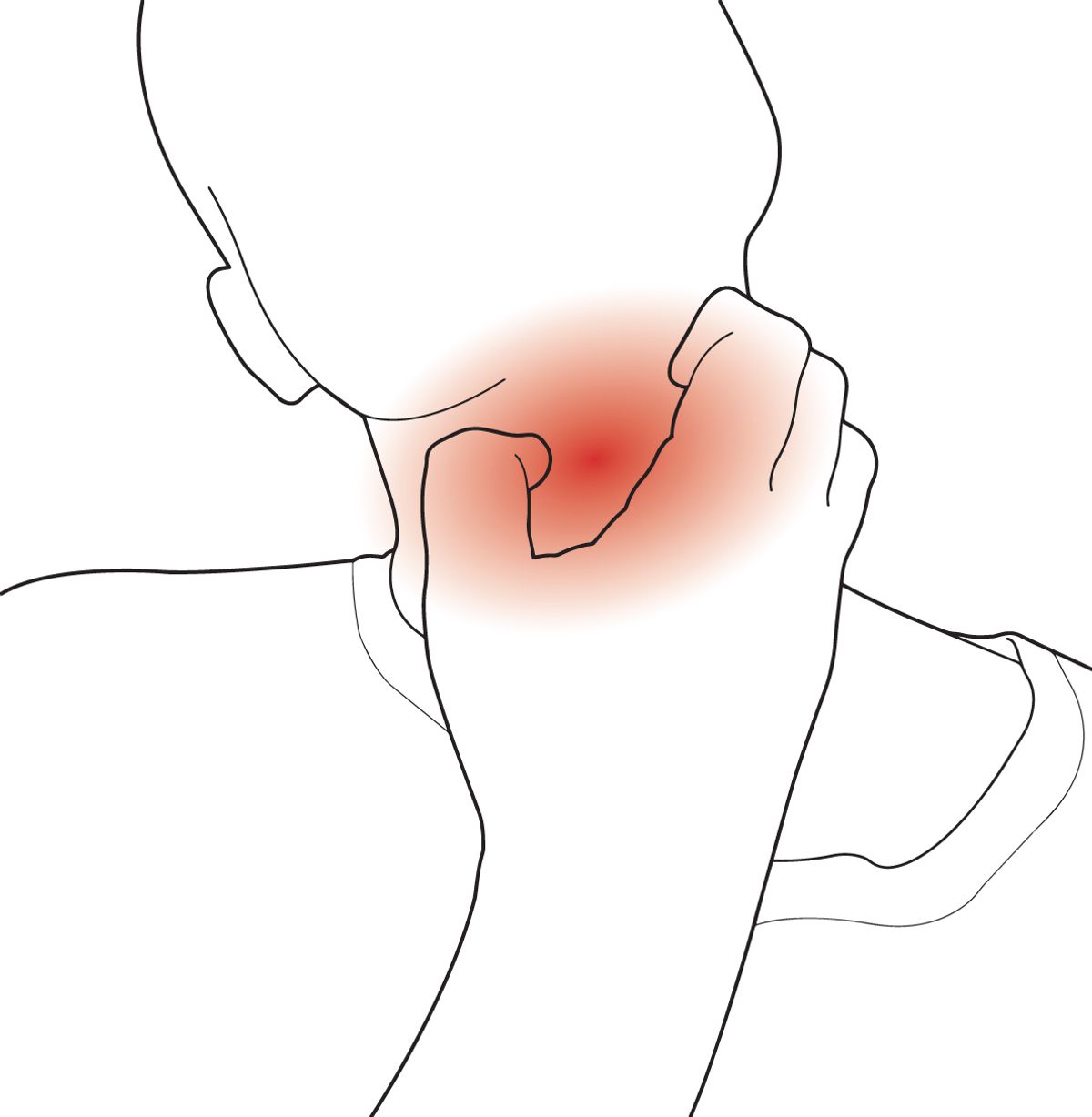 ?Illustration ?of an itchy throat.