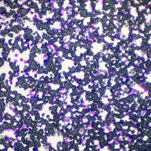 grey and purple cancer cells under a microscope