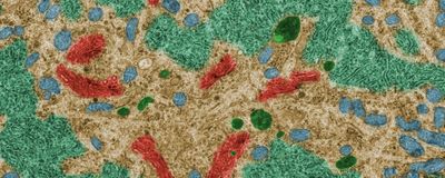 a false color transmission electron microscope image of a neuronal cell body, with lysosomes colored dark green