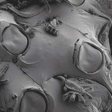 scanning electron microscope image of clawlike microscopic organisms on a smoother surface