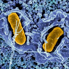 Colorized scanning electron micrograph of Salmonella bacteria in intestinal tissue