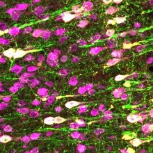 Histological stain of motor neurons in purple and green