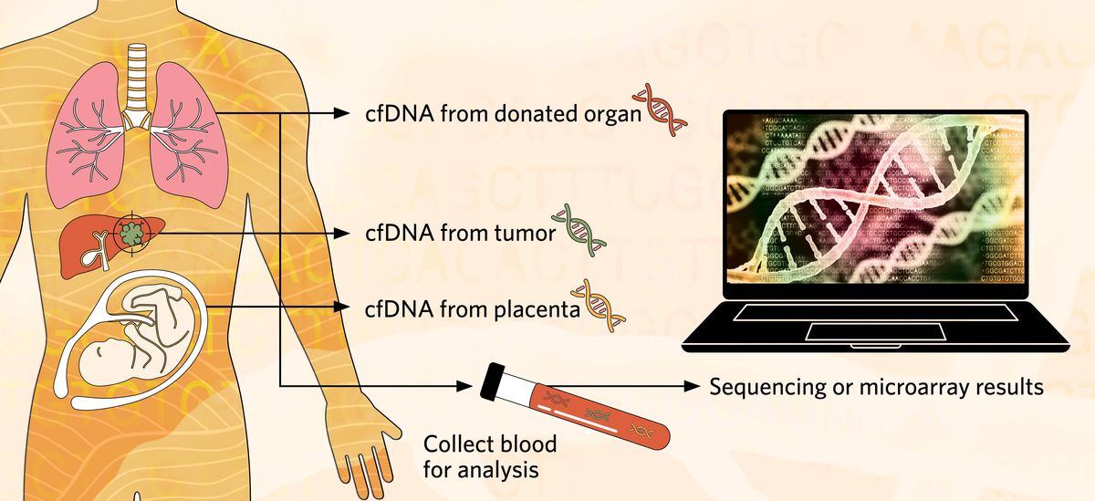 Graphic showing the different locations where cell-free DNA (cfDNA) found in the blood can originate from. Lungs are an example of a source of cfDNA from donated organs, a liver with a tumor is an example of a source of cfDNA from a tumor, and a placenta housing a fetus is an example of fetal cfDNA. A test tube holding blood with cfDNA is then depicted being analysis via sequencing or microarray.