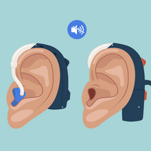 Image of cochlear implant and hearing aid.