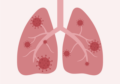 Human lung with viruses