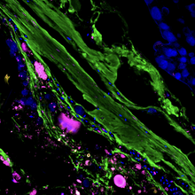 A section of a mouse distal colon showing luminal contents with bacteria in magenta, the mucus lining (green) and the epithelial cell barrier of the gut (blue, right).