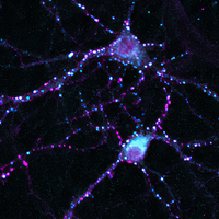 Hippocampal neurons are labeled in blue and purple on a black background