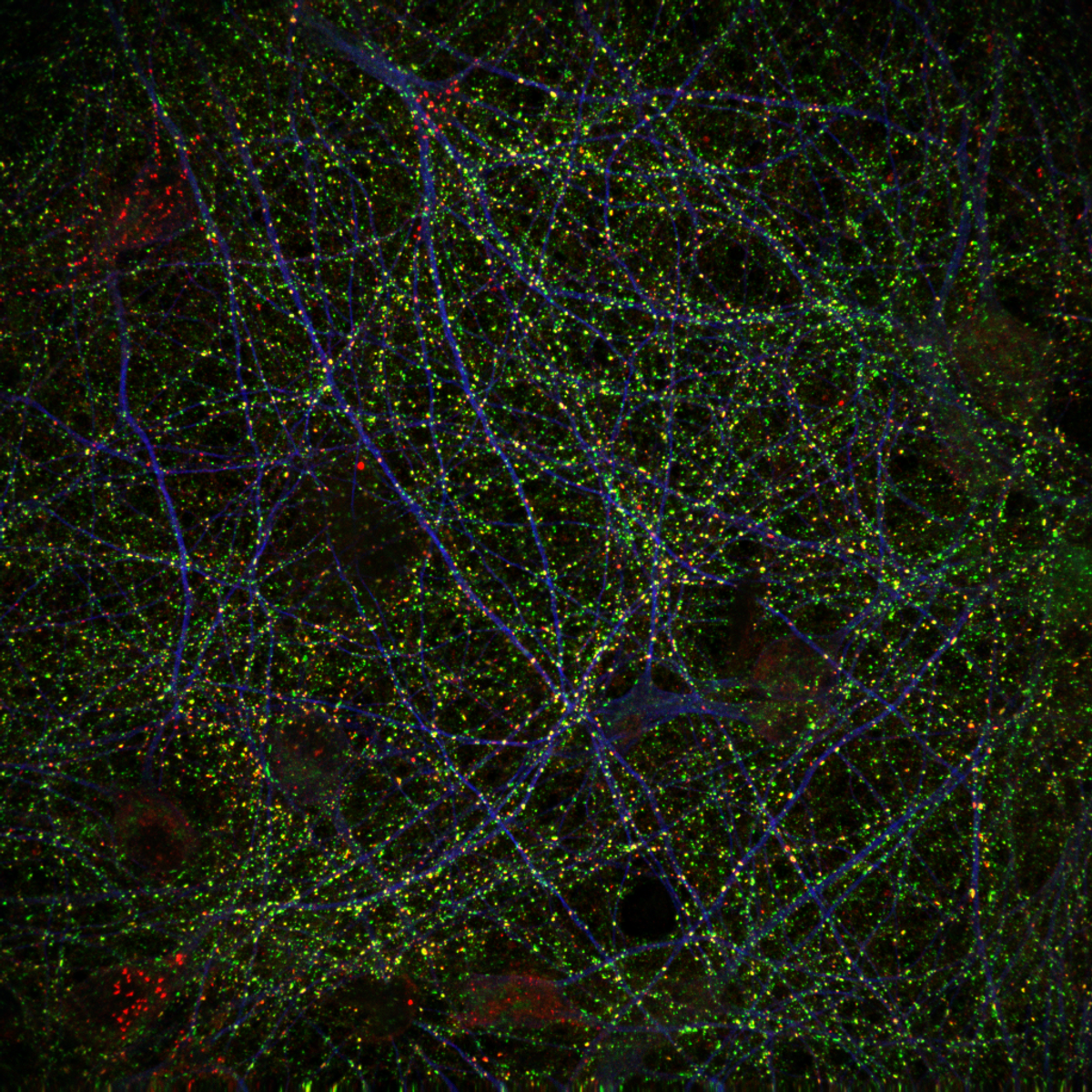 A microscopy image of immunostained neurons after <em >myo</em>-inositol supplementation.