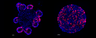 Fluorescent microscopy of a healthy intestinal organoid and a tumor spheroid
