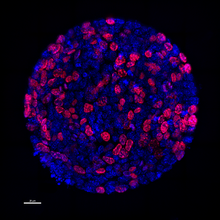 Fluorescent microscopy of a healthy intestinal organoid and a tumor spheroid