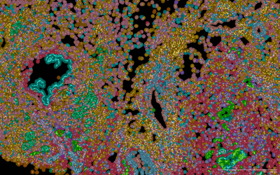 Clumps of pink, yellow, brown, blue, and green dots on a black background.
