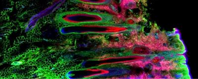 Fluorescence image of healthy scalp skin showing hair follicles and surrounding skin tissue architecture.