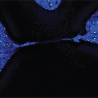 telomere length sticky stuck chromosome aging apoptosis cancer cell oxidative stress