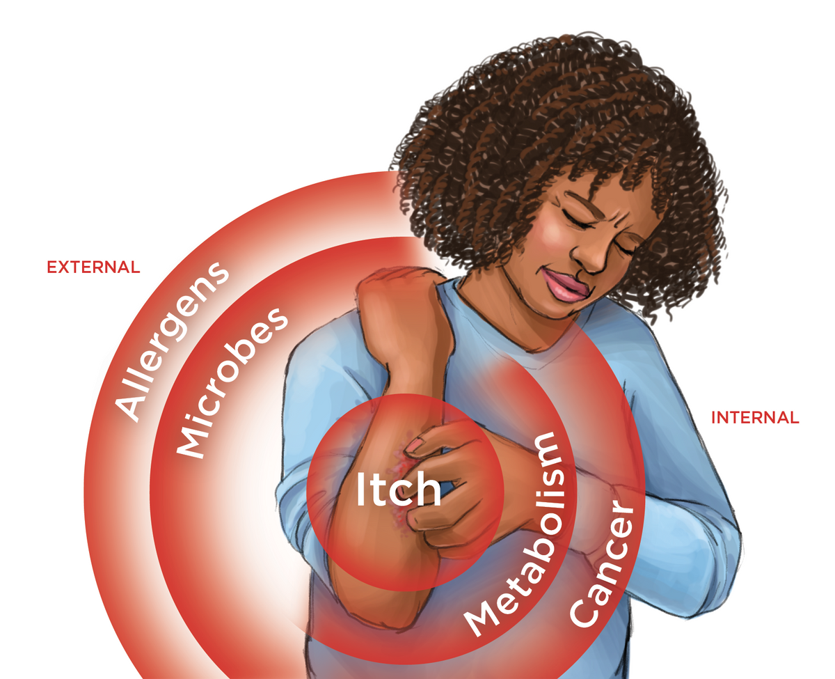 Illustration comparing external and internal reasons for an itch.